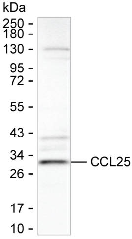 CCL25